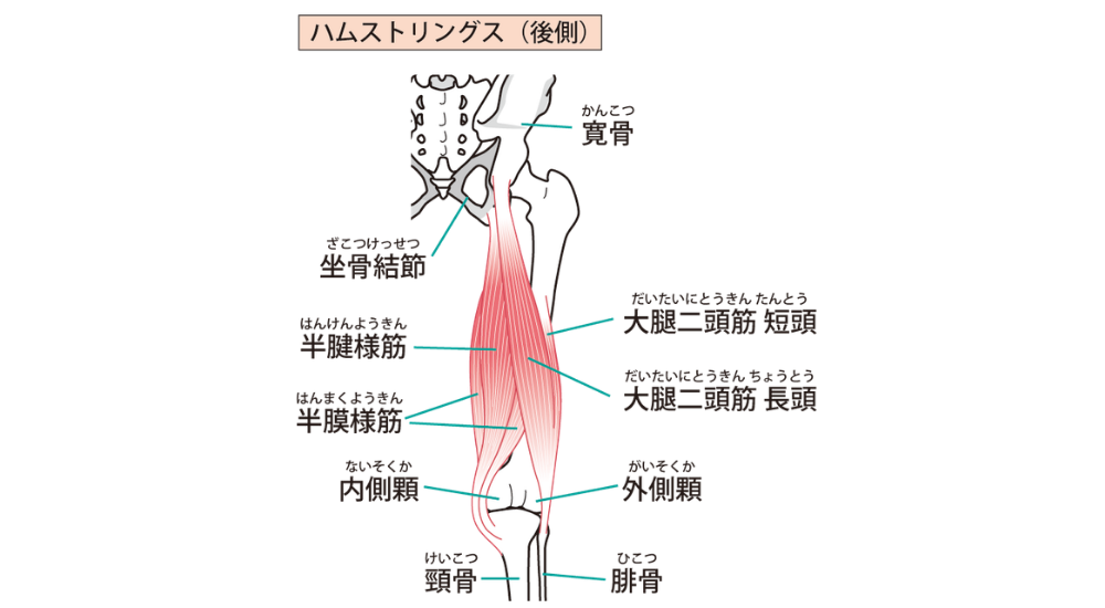 後面から見た骨盤と太ももの骨格イラストで、太もも裏の筋肉群である大腿二頭筋、半腱様筋、半膜様筋が赤く描かれた画像で、【ハムストリングス（大腿後面周辺）】の柔軟性低下や過緊張が引き起こす、前屈みになった時の太もも裏のピキッとする突っ張り感や、骨盤が下方に引っ張られることによる後傾・フラットバック由来の慢性的な腰痛のメカニズムを解説している様子。体の使い方説明やエクササイズ時に使われる（使いたい）筋肉としての説明、筋肉の機能的な解説時に積極的に使用してください。